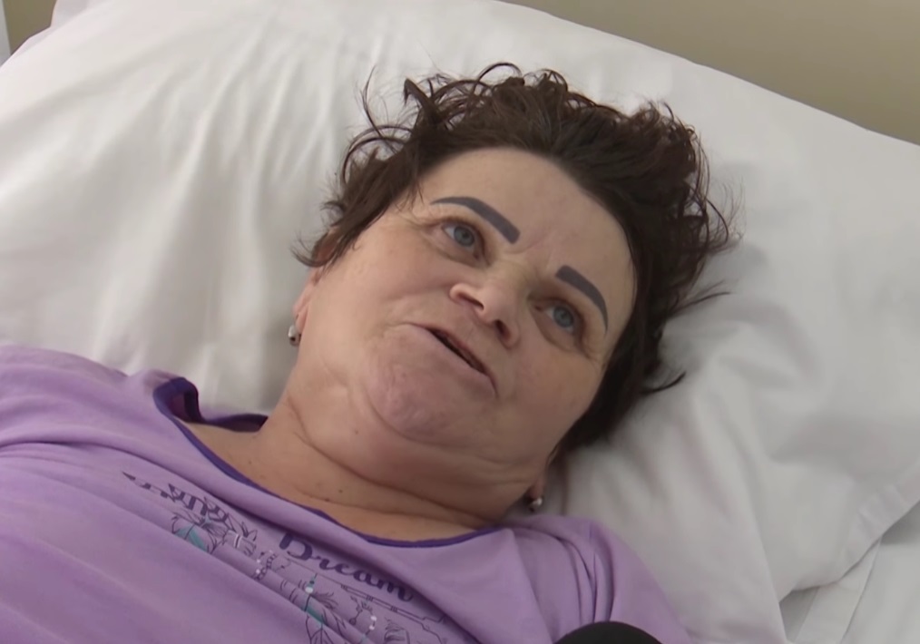 Duța Batog, pe patul de spital, după operație, fericită că a scăpat de tumoare