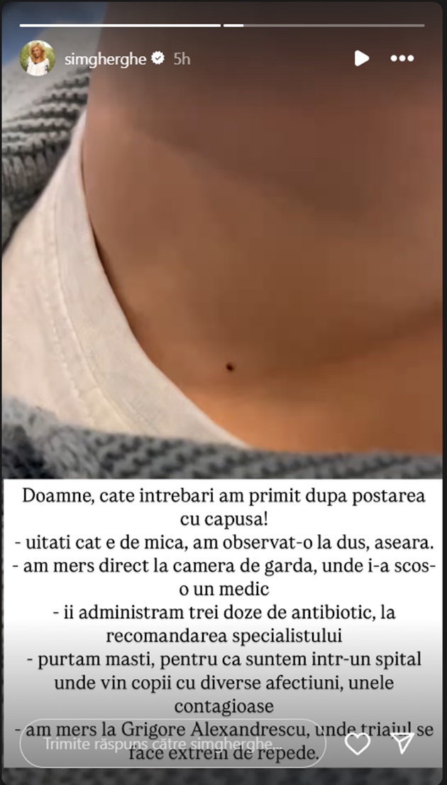 Fotografia pe care i-a făcut-o Simona Gherghe fiului ei după ce a observat că are  o căpușă înfiptă în pielea de pe gât