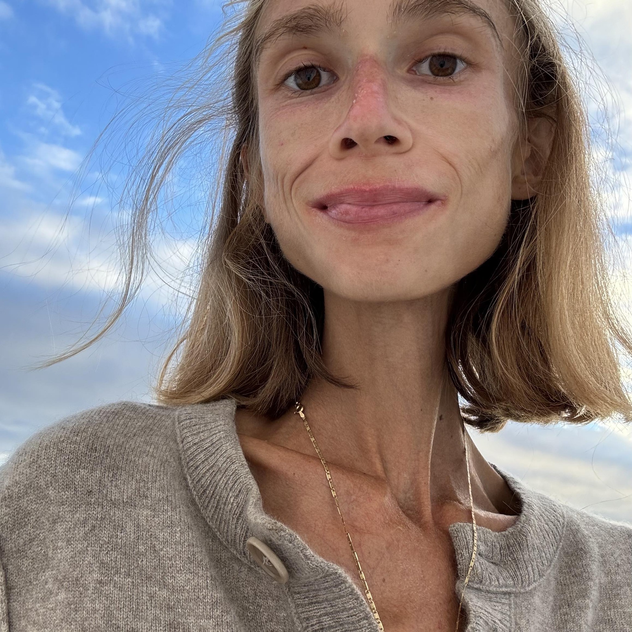 Karolina Krzyzak slăbită și slabă, la 22 de kilograme, făcându-și un selfie cu puțin timp înainte să moară din cauza dietei extreme