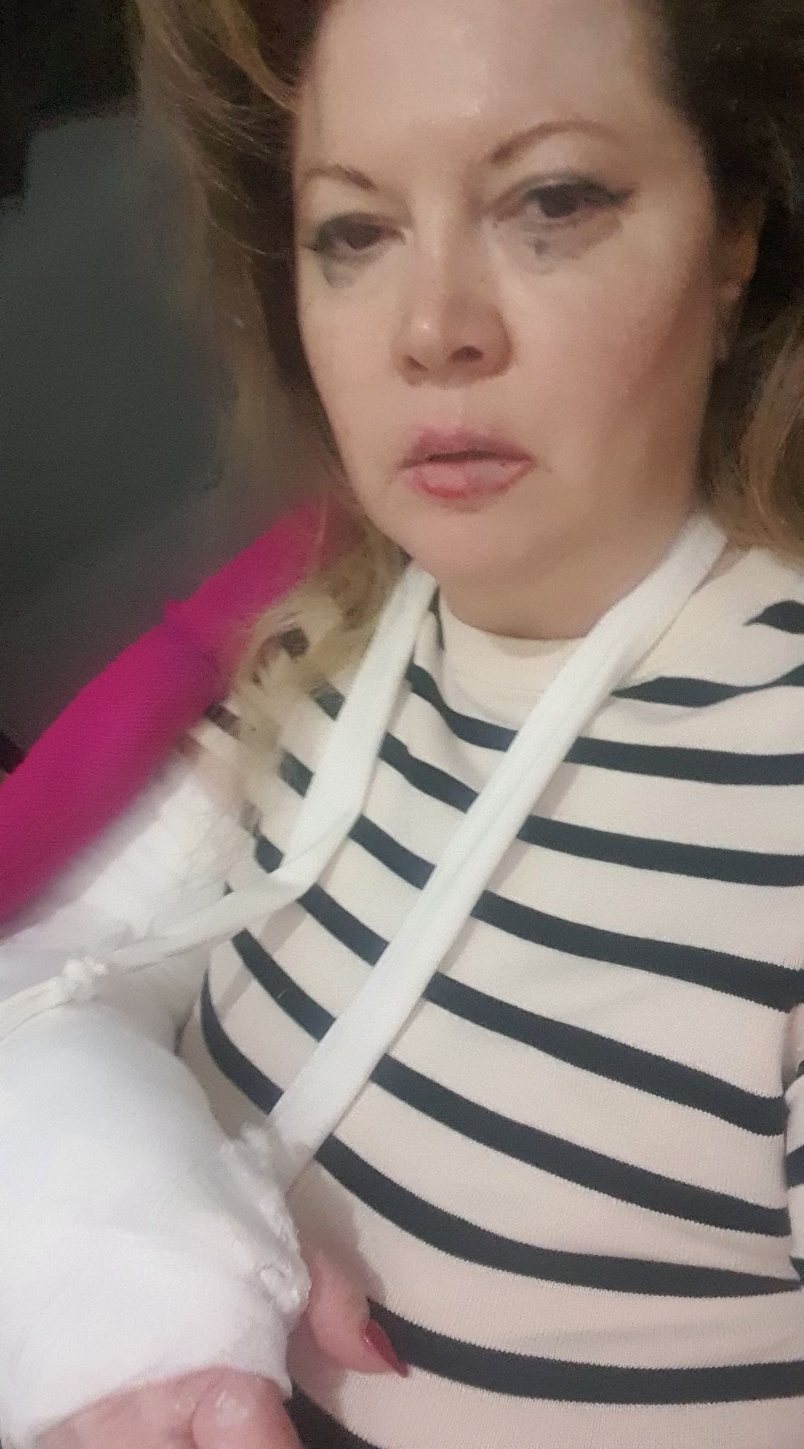 Oana Lis cu mâna în ghips și cu rimelul curs sun ochi după ce a plâns în urma căzăturii prin care a trecut.