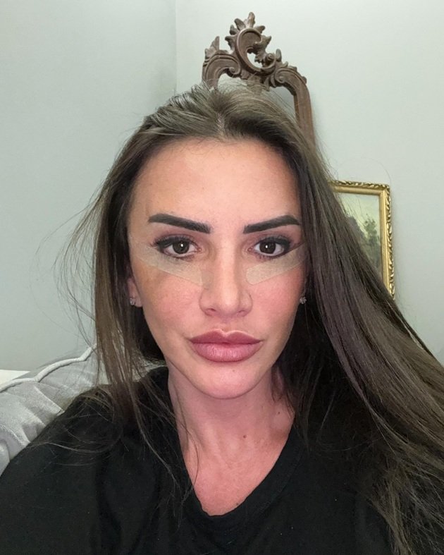 Mara Bănică făc&acirc;ndu-și un selfie după liftingul facial făcut la final de 2023