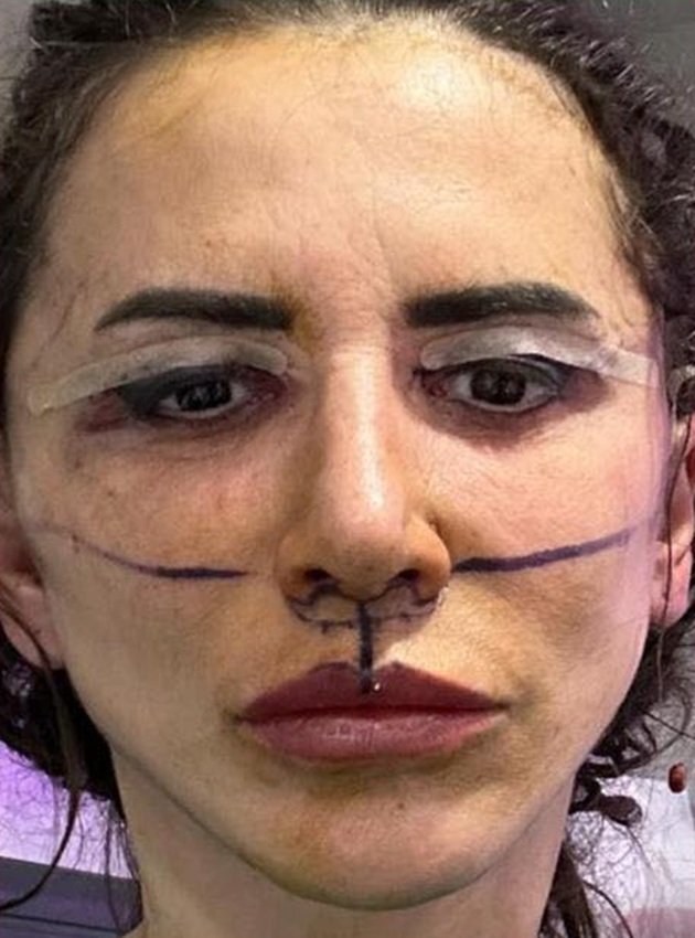 Mara Bănică &icirc;nainte de liftingul facial, c&acirc;nd medicul estetician i-a pregătit fața pentru operație