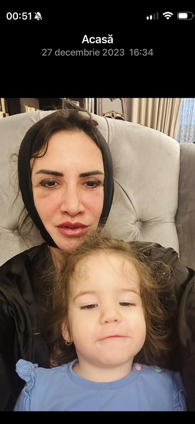 Mara Bănică fotografiindu-se &icirc;n timp ce o ținea pe fiica ei &icirc;n brațe după liftingul facial făcut &icirc;n 2023, c&acirc;nd &icirc;ncă purta fașa neagră care &icirc;i ținea pielea str&acirc;nsă după operație.