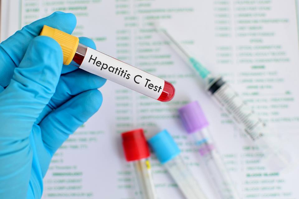 analzie hepatita