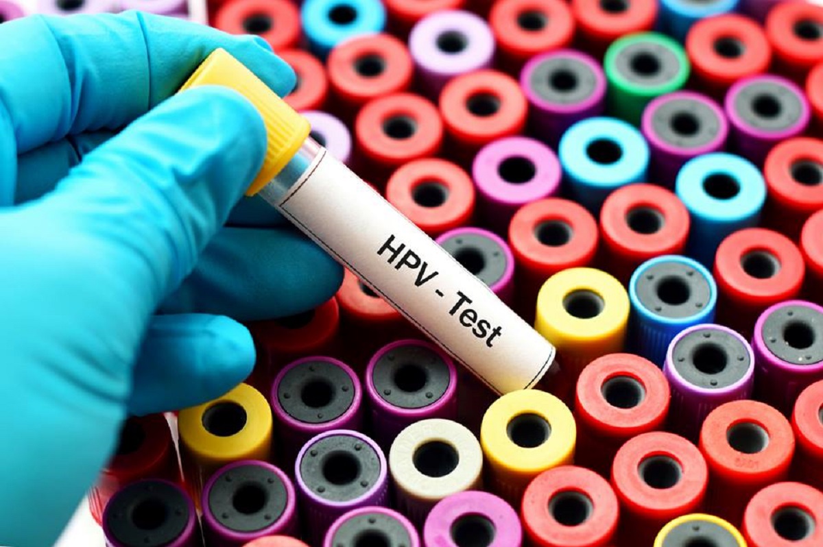 test pentru hpv