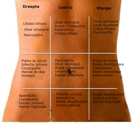 Dureri De Stomac Harta Durerilor De Stomac
