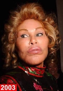 operatii estetice nereusite Jocelyn Wildenstein operatii