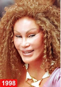 operatii estetice nereusite operatii estetice Jocelyn Wildenstein