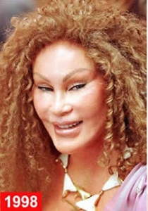 operatii estetice Jocelyn Wildenstein