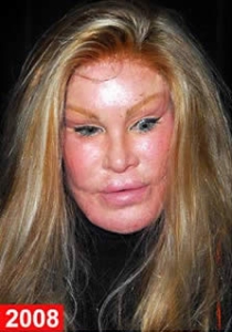 operatii estetice Jocelyn Wildenstein