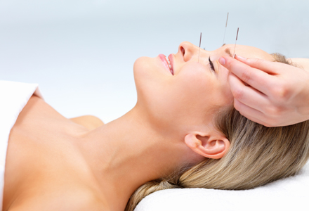 sedinta de acupunctura