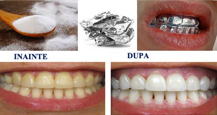 Albirea Dintilor Cu Bicarbonat Divahair Ro
