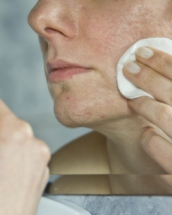 Cum sa scapi de cicatricele lasate de acnee: iata 6 remedii naturiste! 