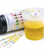 10 cauze nebanuite ale infectiei urinare: dusmanii ascunsi ai aparatului urinar