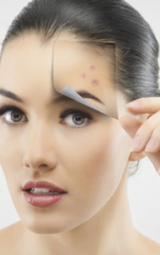 Harta acneei: ce dezvaluie cosurile despre starea ta de sanatate