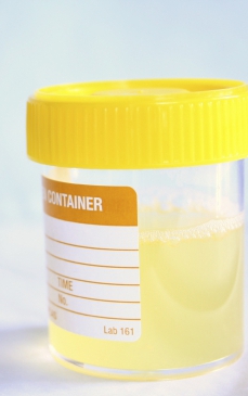 Cinci trucuri care te țin departe de o infecție urinară în sezonul cald