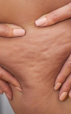 Scapă de celulită într-o săptămână cu semințe de floarea-soarelui