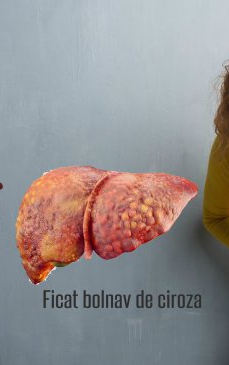 Ciroza hepatică: simptome prezente în ultima fază a bolii