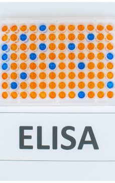 Cât costă testul ELISA în România