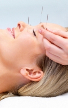 Acupunctura – relaxare si vindecare