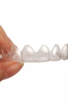 Aparatul dentar invizibil: avantaje si dezavantaje