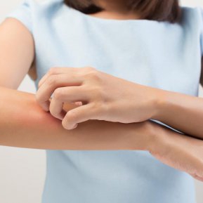 Sindromul Stevens-Johnson, boala rară care afectează pielea