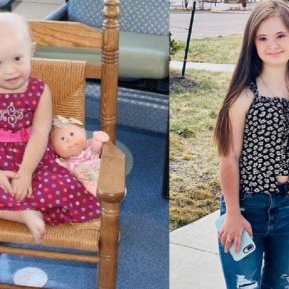 Medicii nu-i dădeau șanse la viață, dar această fată cu sindromul Down a dovedit că se poate