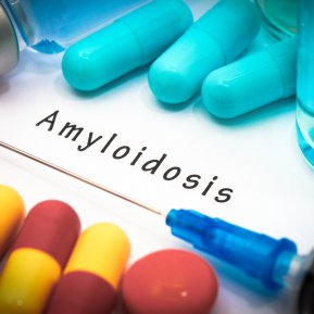 Totul despre amiloidoza: ce este, de ce apare și cum o tratezi