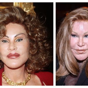 Supranumită "femeia pisică", Jocelyn Wildenstein și-a schimbat radical înfățișarea după zeci de operații estetice. Uite cum arată acum