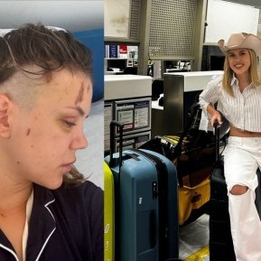Emily Burghelea trece prin clipe de coșmar după accident. A ajuns pe masa de operație
