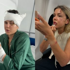 Cum se mai simte Emily Burghelea, la trei săptămâni după accidentul grav în care a fost implicată. „Am rămas cu o gaură în cap"