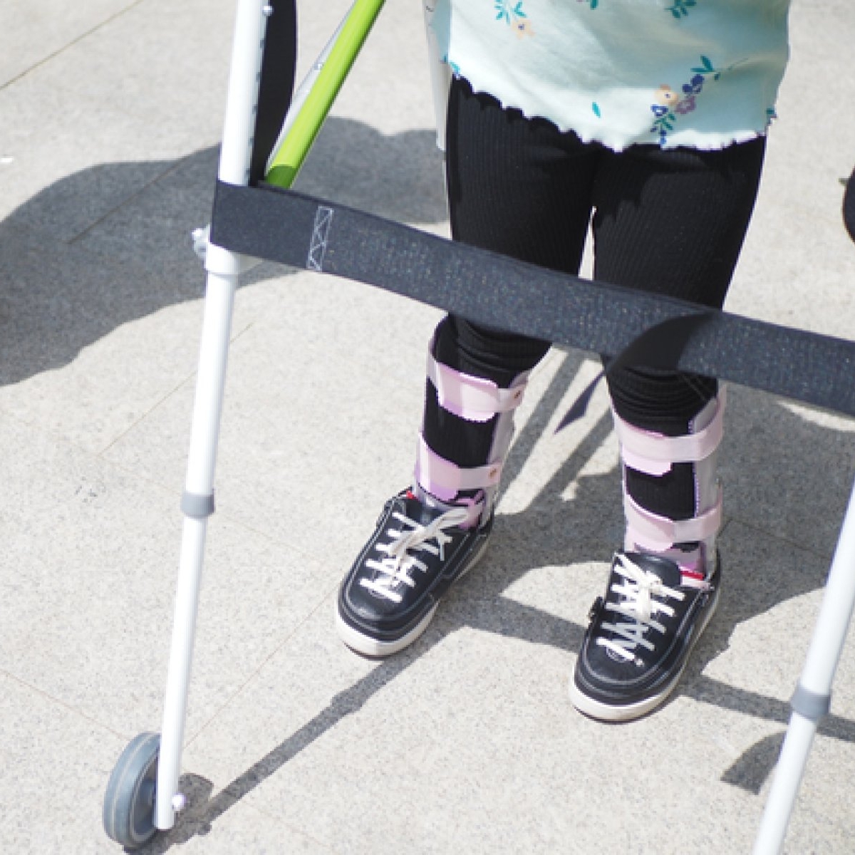 Ataxia Friedreich: cauze, simptome și tratament