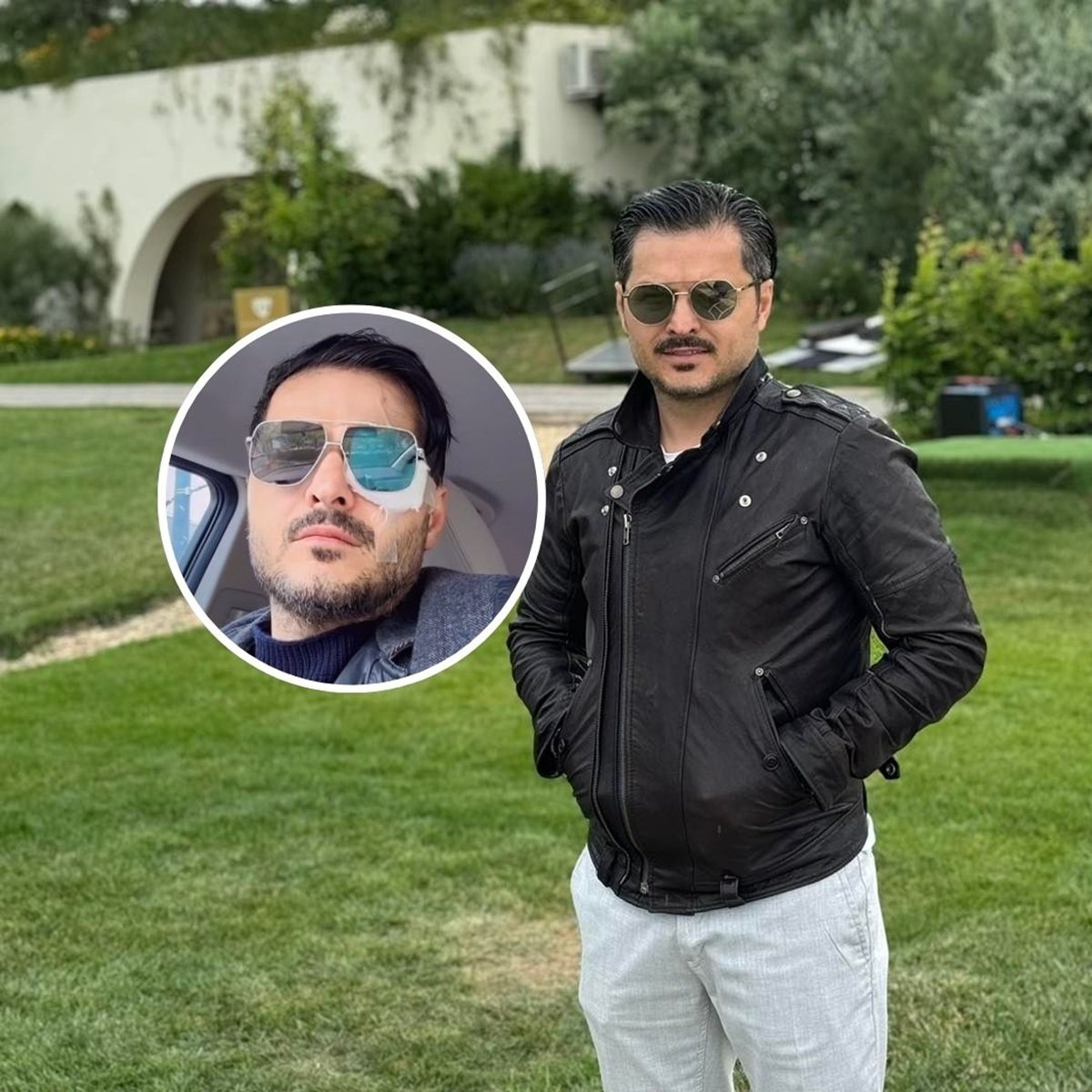 Liviu Vârciu, cu ochiul bandajat pe internet. De ce a ajuns vedeta pe mâinile medicilor