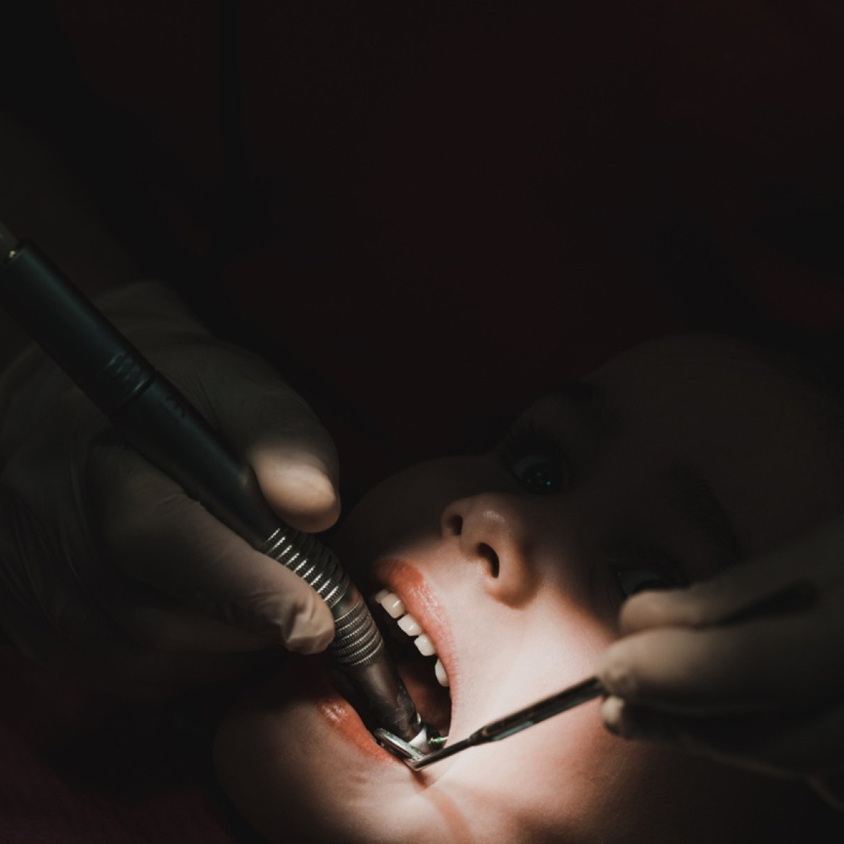 Sara nu este singurul copil mort după o vizită la stomatolog în România. Un băiețel și-a găsit sfârșitul în condiții similare la Pitești