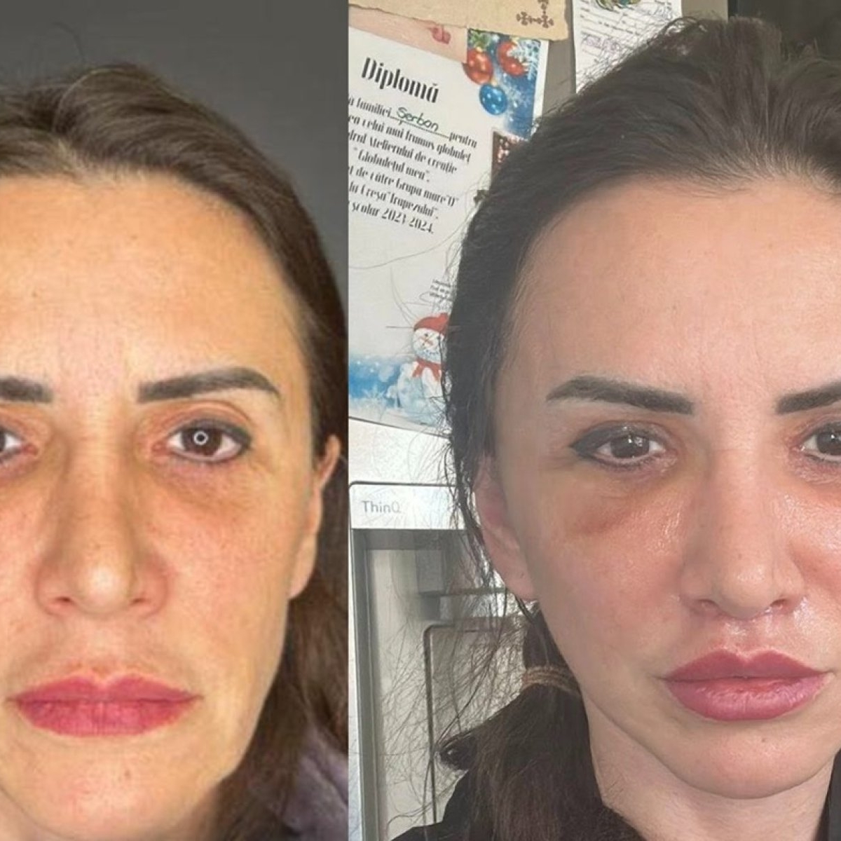 Mara Bănică, mesaj tranșant pentru femeile care o judecă pentru decizia de a face lifting facial: „De asta nu puteți dormi noaptea?”