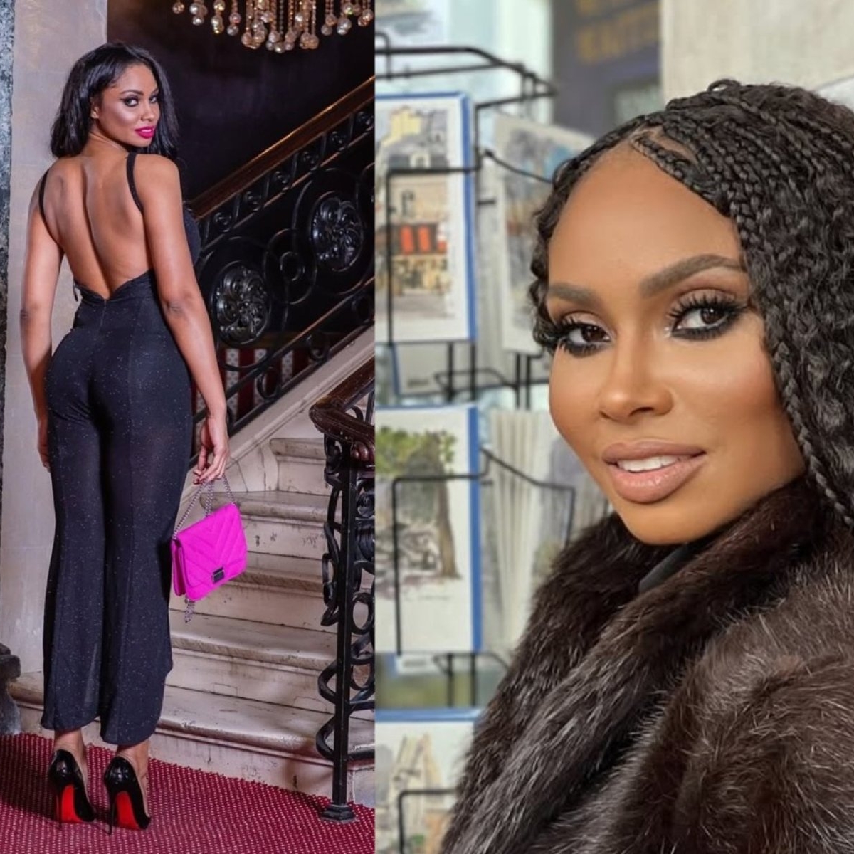 Laurette a trecut prin clipe de coșmar după ce a ajuns imobilizată la pat. Ce dezvăluiri șocante a făcut despre procedura estetică care i-a pus în pericol viața