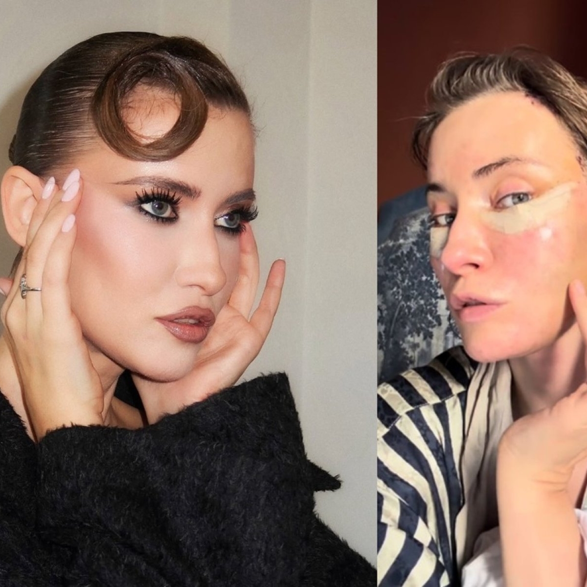 Iulia Albu și-a făcut lifting facial la 44 de ani. Cum arată după operație: „Fără filtre, fără vrăjeală”