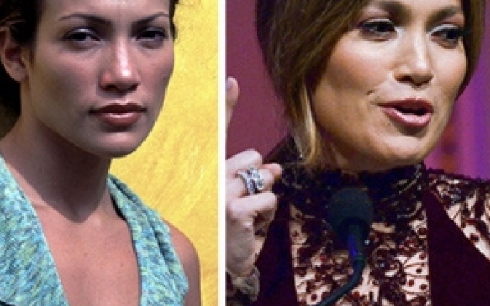J.Lo si-a operat nasul? Analizeaza si tu imaginile!  