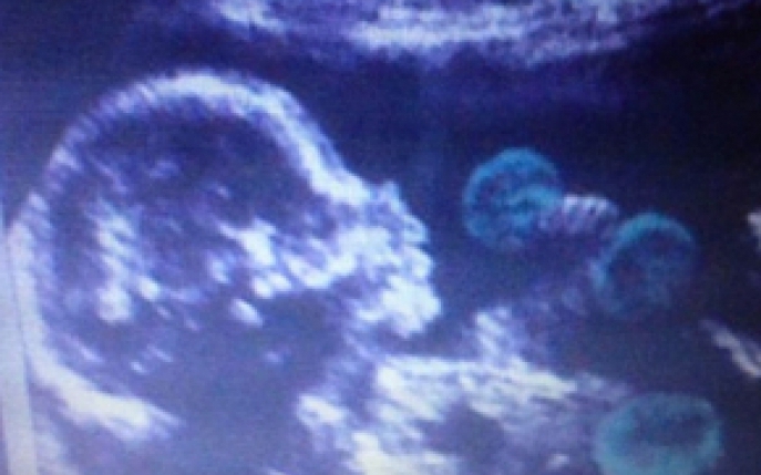 Vezi prima ecografie cu bebelusul lui Mircea Badea! 