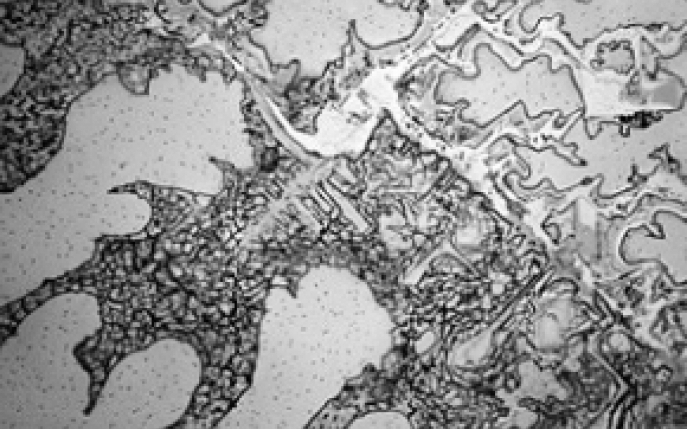 Aceste imagini cu lacrimi la microscop dezvaluie un mister socant