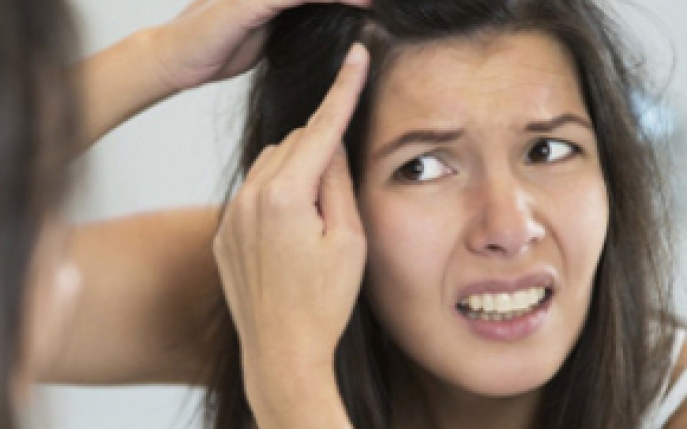 Ce sa faci daca ai coji pe scalp: top 5 tratamente naturiste