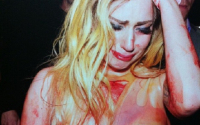Lady Gaga a ajuns la spital! Afla motivul!