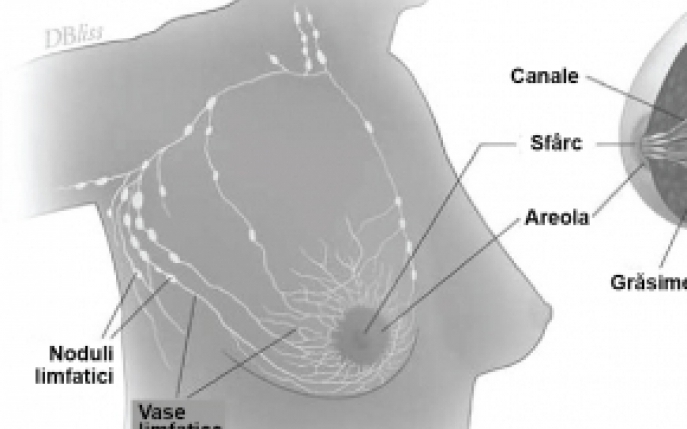 Cum se stabileste stadiul cancerului de san. Ghid complet pentru orice femeie