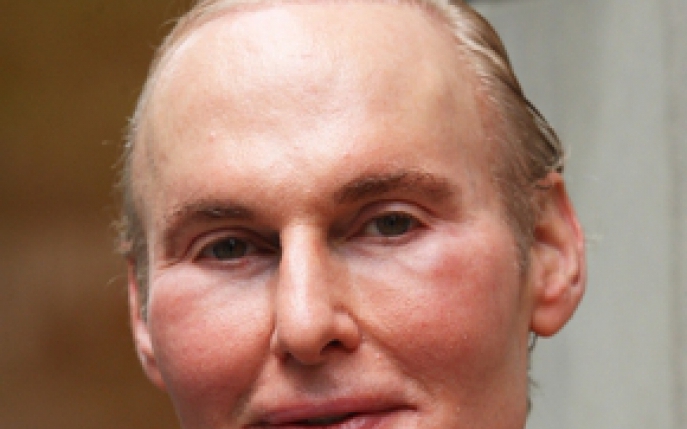 Regele Colagenului, dermatologul favorit al celebritatilor, s-a sinucis! Vezi cum arata la 65 de ani!