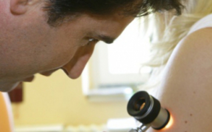 Cum se pune diagnosticul de melanom, cel mai agresiv cancer de piele adus de soare!