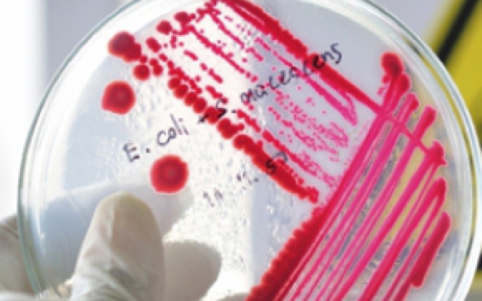 Te poti infecta cu E.coli din locuri nebanuite: cum sa te feresti de bacterie