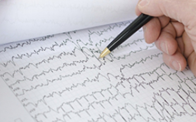 7 cauze neasteptate ale unui puls neregulat