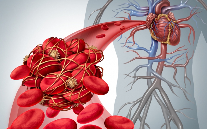 Cum să îți dai seama că ai un cheag de sânge în corp: simptome și complicații