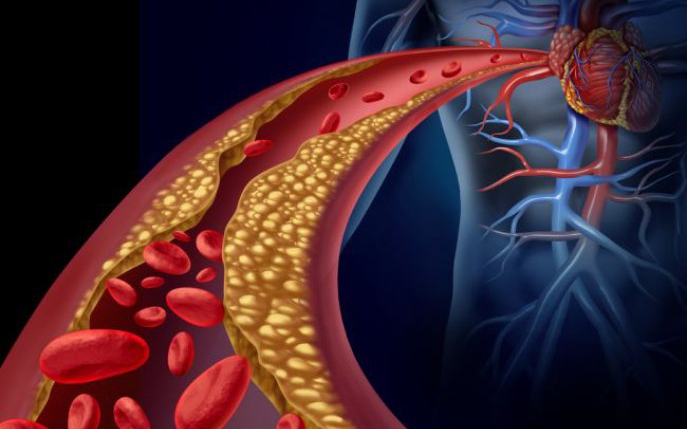 Ce se întâmplă dacă ai colesterolul prea mic