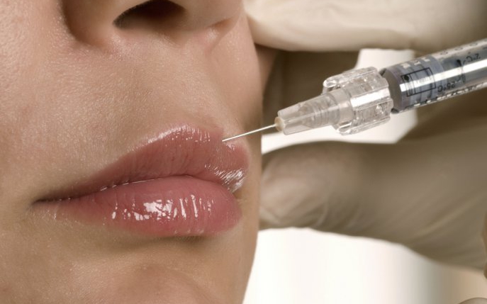 Ce preț are o operație de mărire a buzelor în România